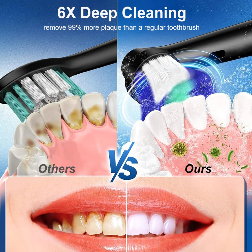 Electric Toothbrush – Deep Clean Whitening With Ultrasonic Rotation And Replacement Heads
